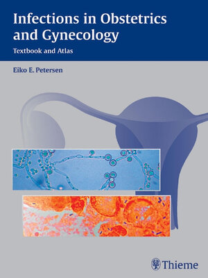 cover image of Infections in Obstetrics and Gynecology